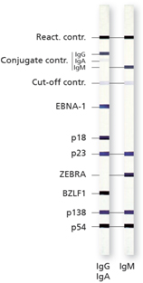 Иммуноблот ToRCH скрининг IgМ (не для использования в медицинских целях)